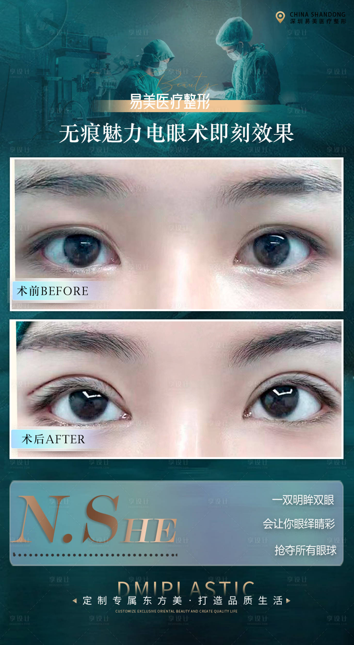 源文件下載【享設計】搜索編號：54560020393491031【醫美案例雙眼皮海報】