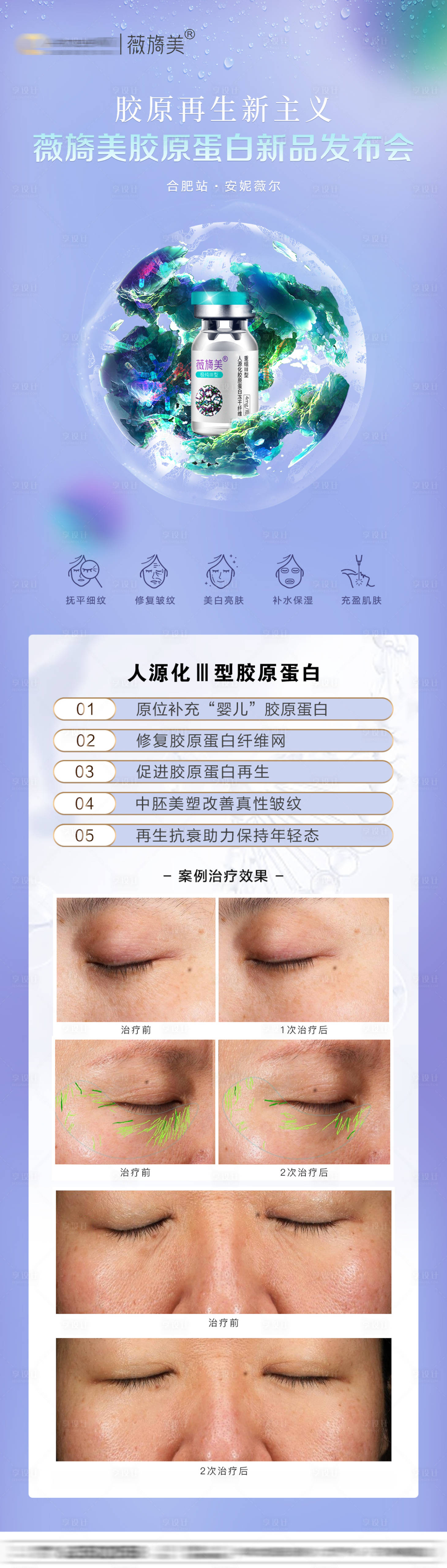 源文件下載【享設(shè)計(jì)】搜索編號：81300020346035684【薇旖美活動(dòng)案例圖】