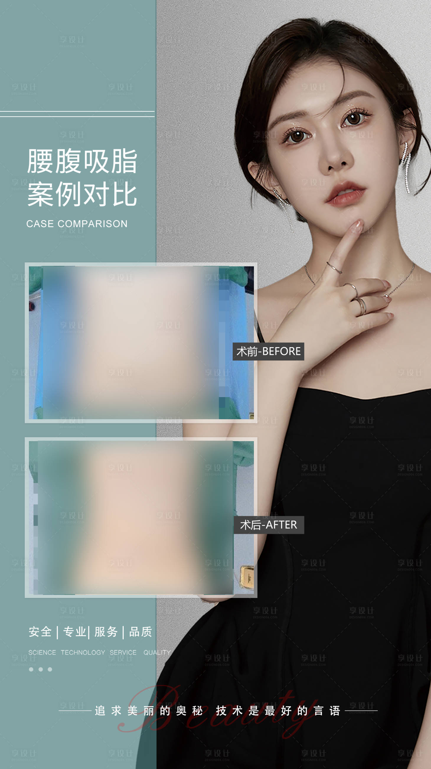 源文件下載【享設計】搜索編號：36280020340391005【醫美腰腹抽脂案例海報】