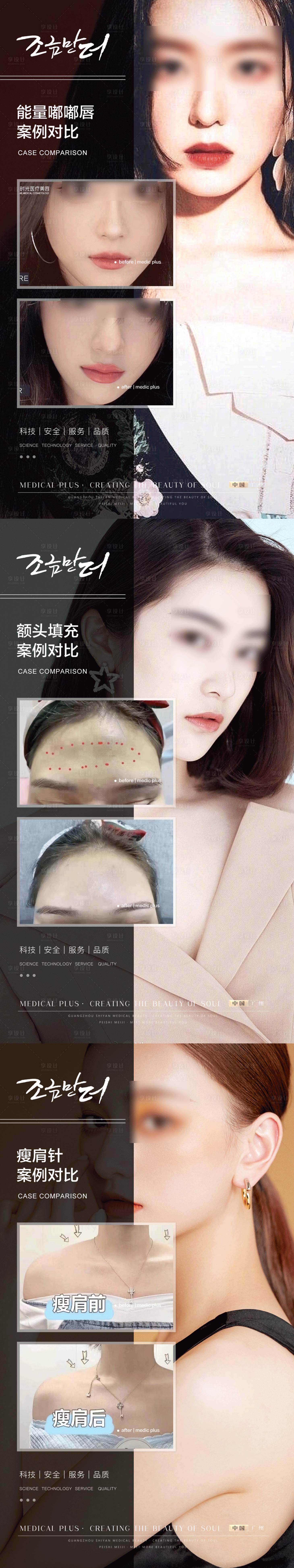 源文件下载【享设计】搜索编号：61580020468639614【整形对比海报】