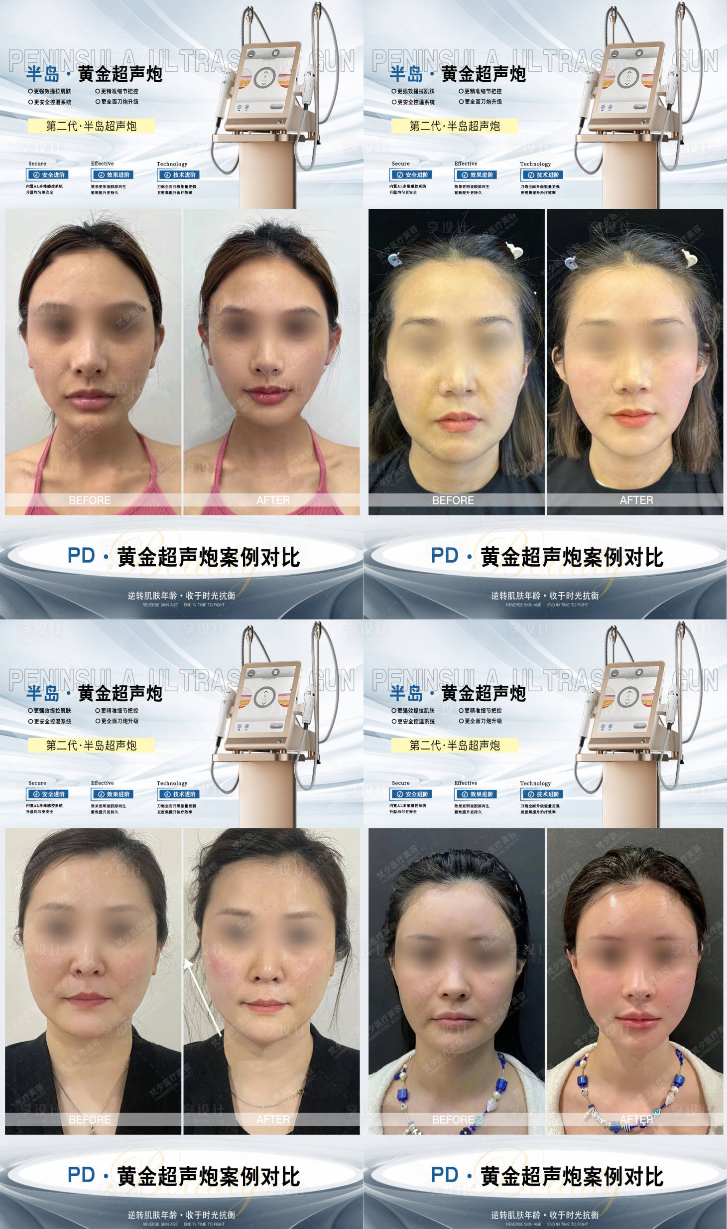 源文件下載【享設計】搜索編號：15560020380807216【超聲炮海報】