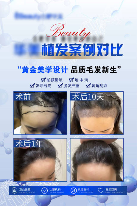 源文件下载【享设计】搜索编号：82710020313552111【案例对比植发海报】