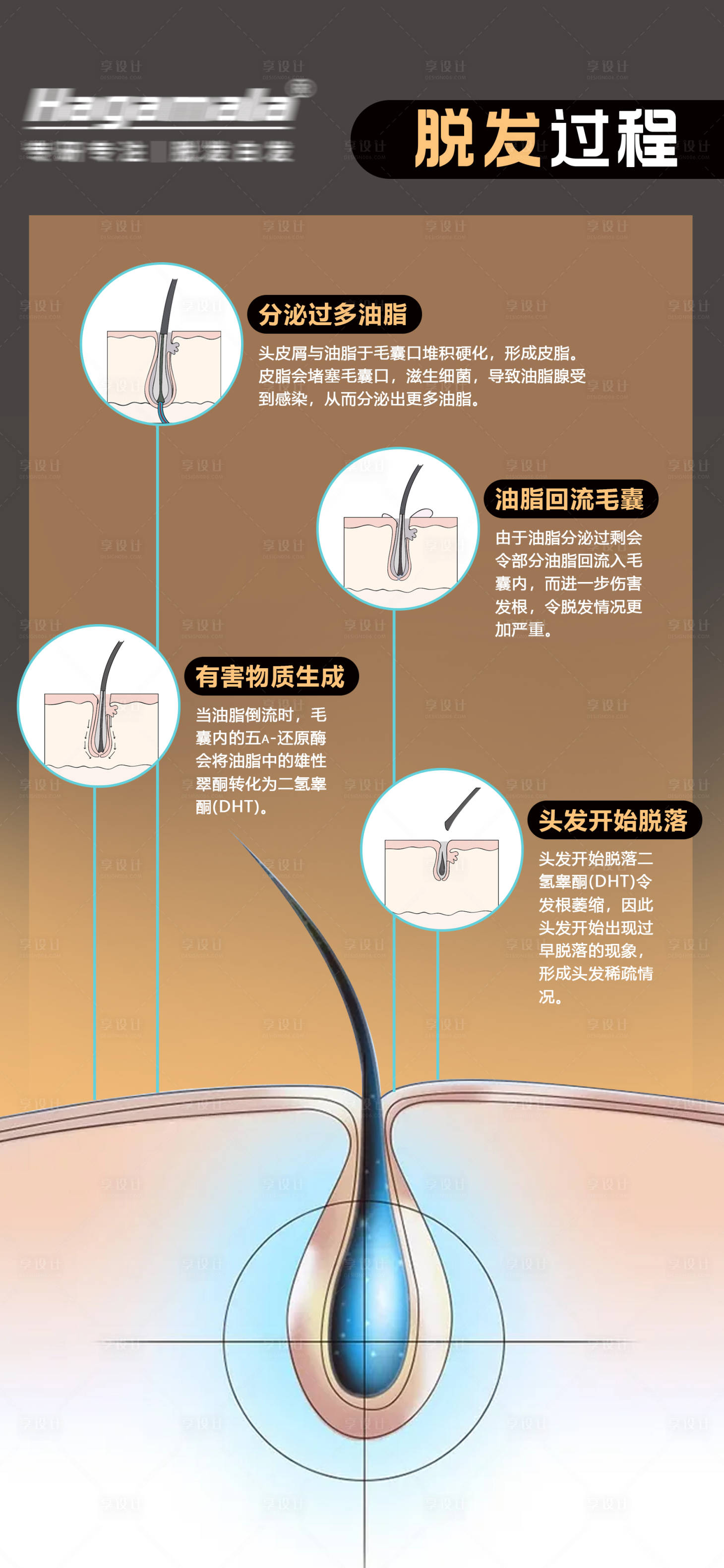 源文件下载【脱发过程海报】编号：20231121164858196