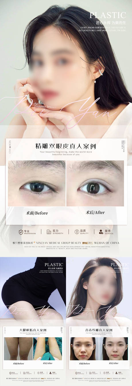 源文件下載【享設計】搜索編號：18460020419548837【整形案例3】