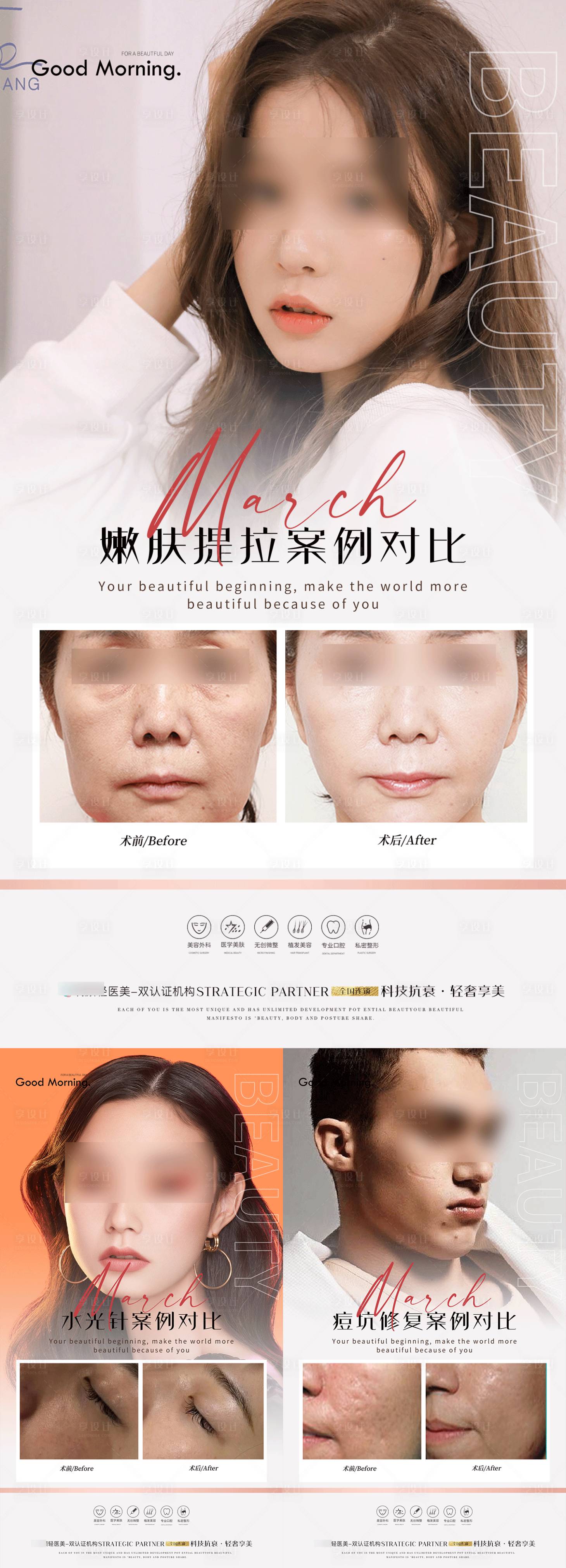 源文件下載【享設(shè)計(jì)】搜索編號(hào)：47400020374883771【醫(yī)美美容案例海報(bào)】
