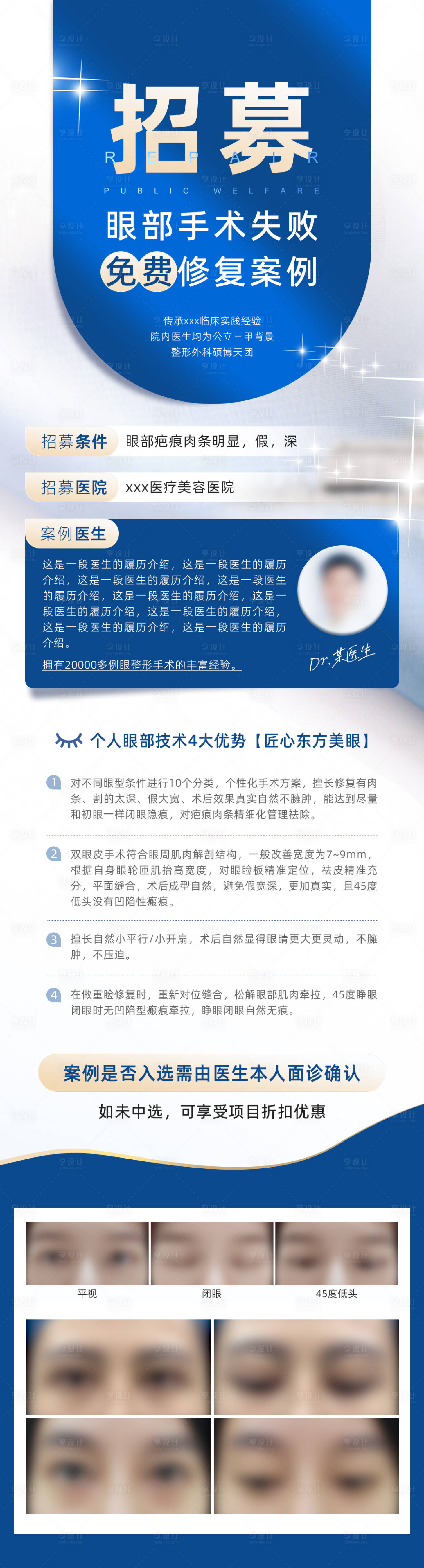 源文件下载【医美案例招募图】编号：35770020671179460