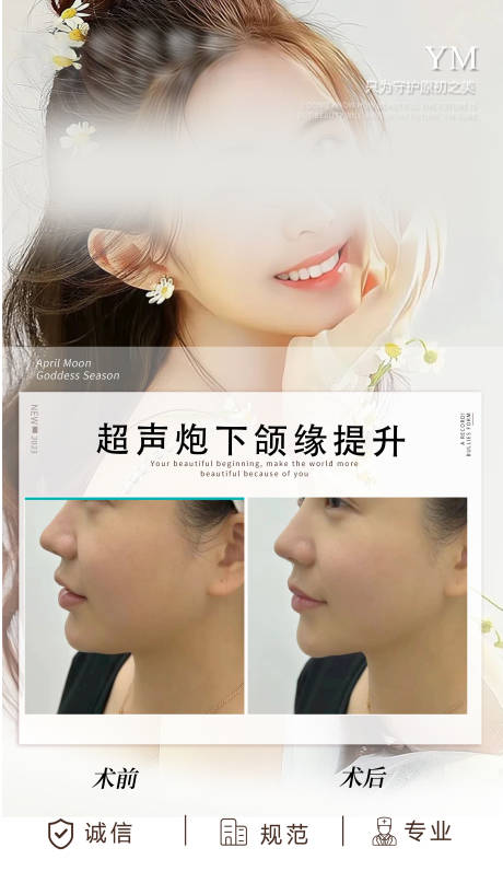 源文件下载【超声炮下颌缘提升海报】编号：25680020280661316