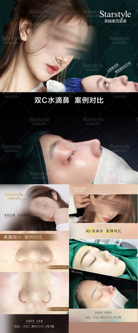 源文件下载【医美鼻子案例对比系列海报】编号：96420020690144776