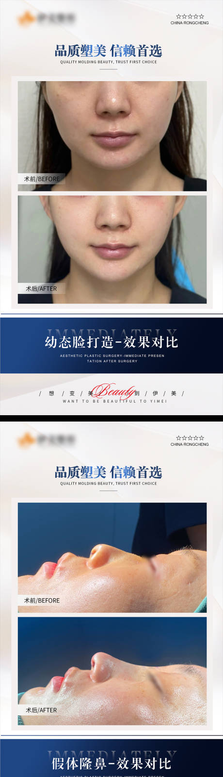 源文件下载【医美案例模板对比】编号：84090020202593442