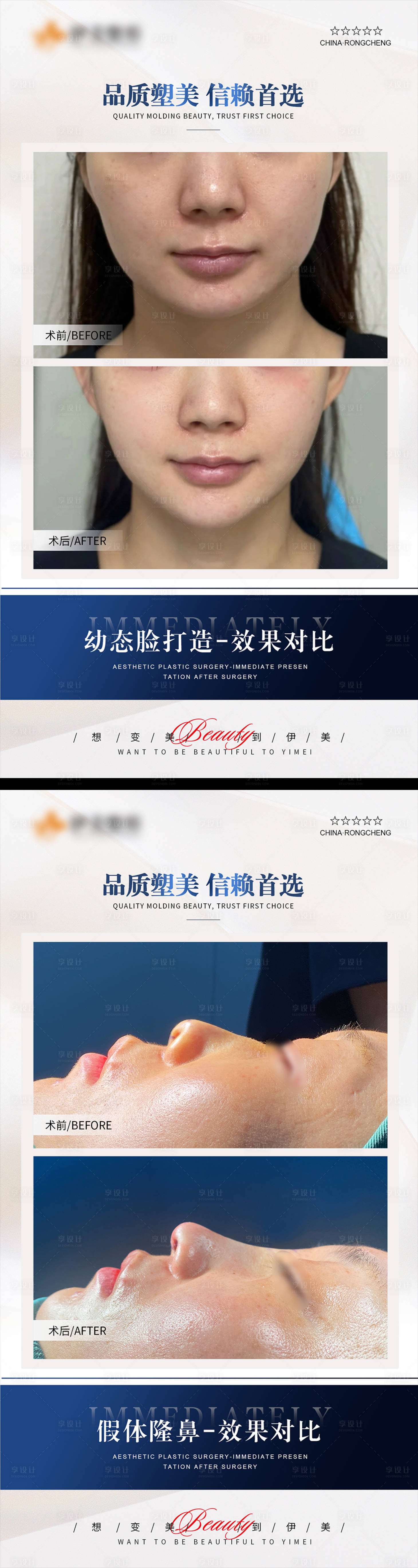 源文件下載【享設(shè)計(jì)】搜索編號：84090020202593442【醫(yī)美案例模板對比】