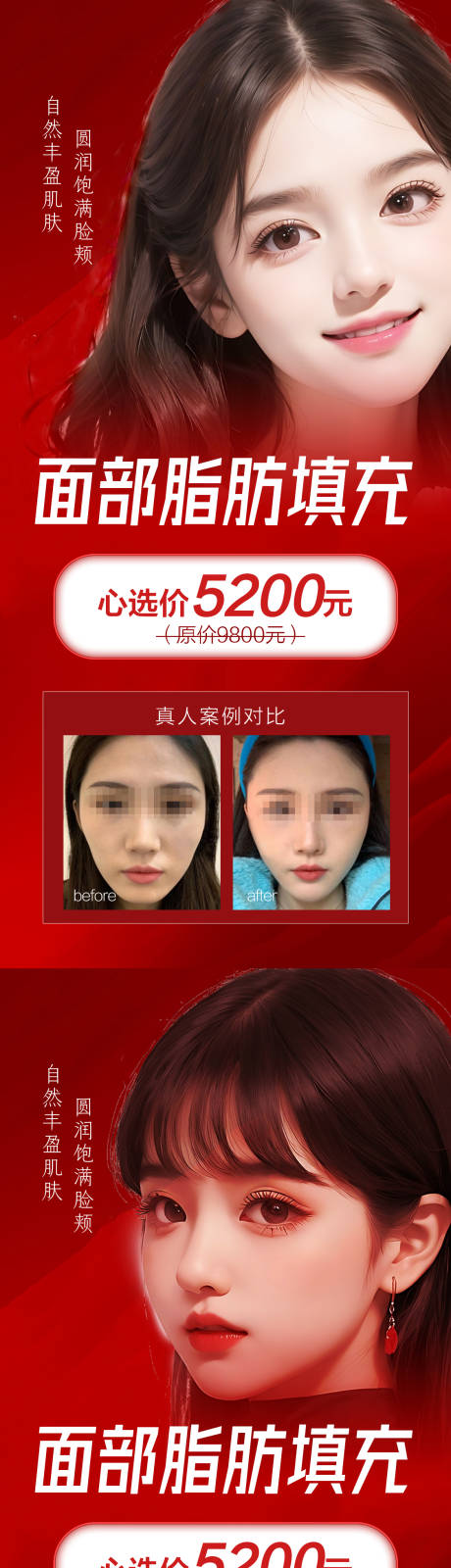 源文件下载【医美面部填充案例活动海报】编号：15000020374993369