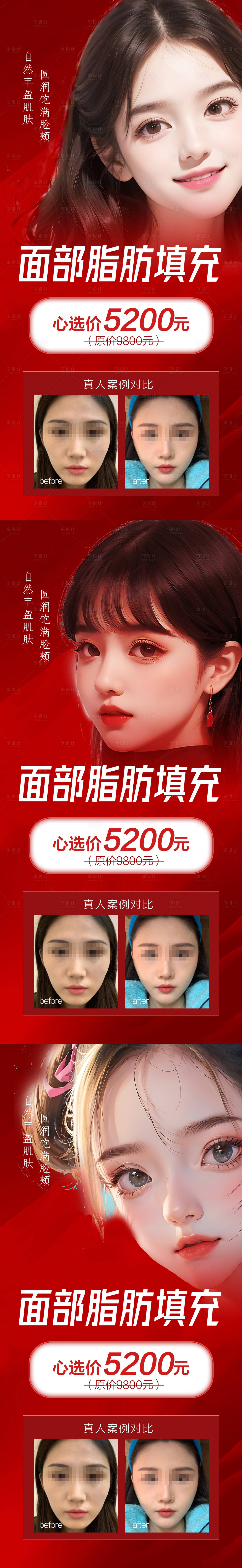 源文件下载【享设计】搜索编号：15000020374993369【医美面部填充案例活动海报】