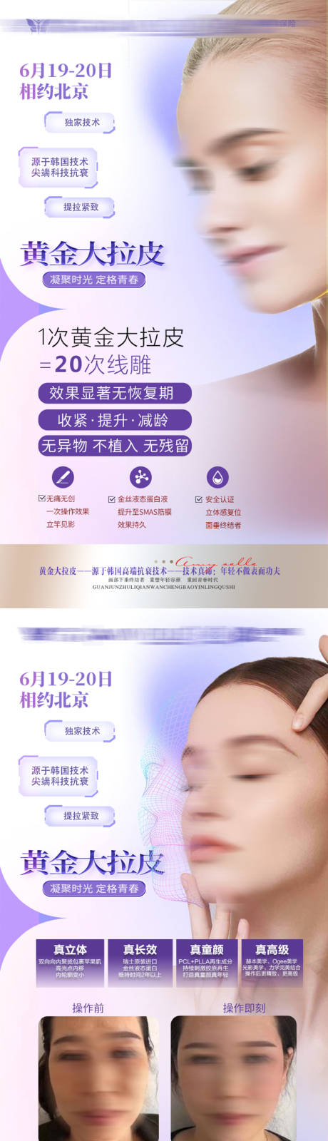 源文件下载【医美项目招商海报】编号：13760020155395805