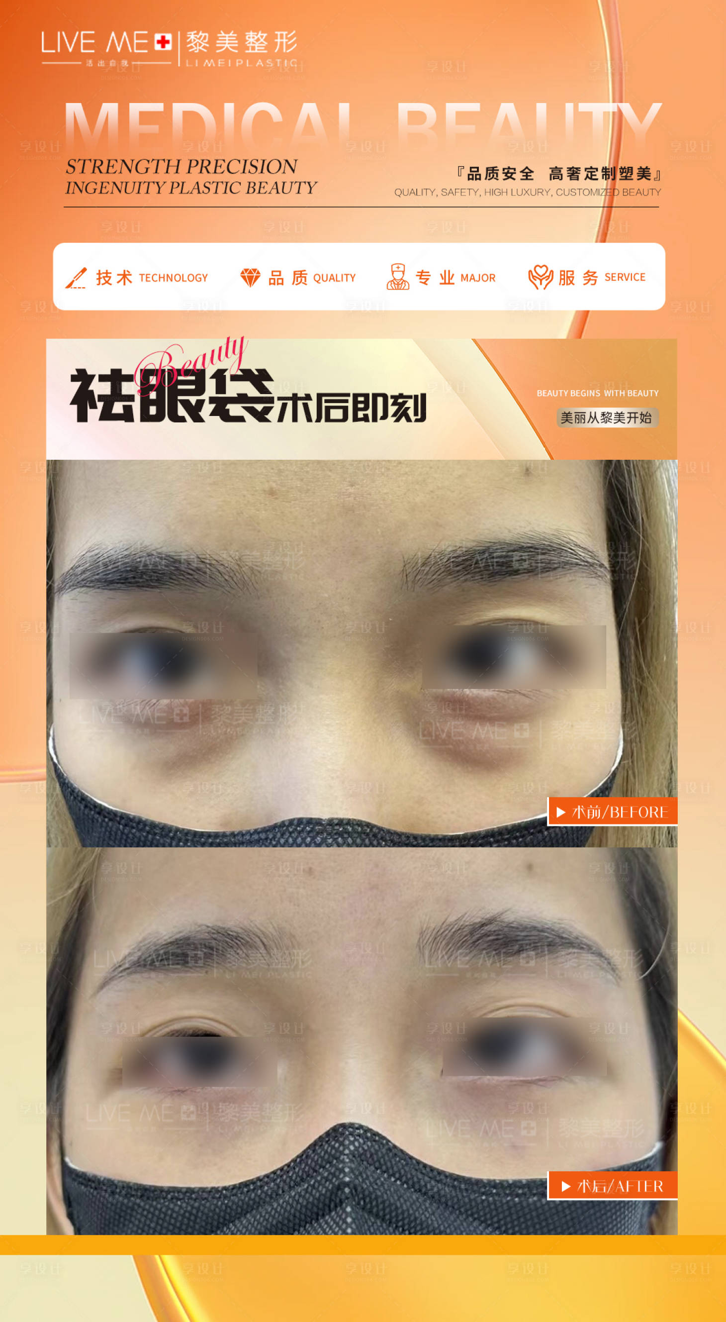 源文件下载【祛眼袋案例海报】编号：64450020433878035