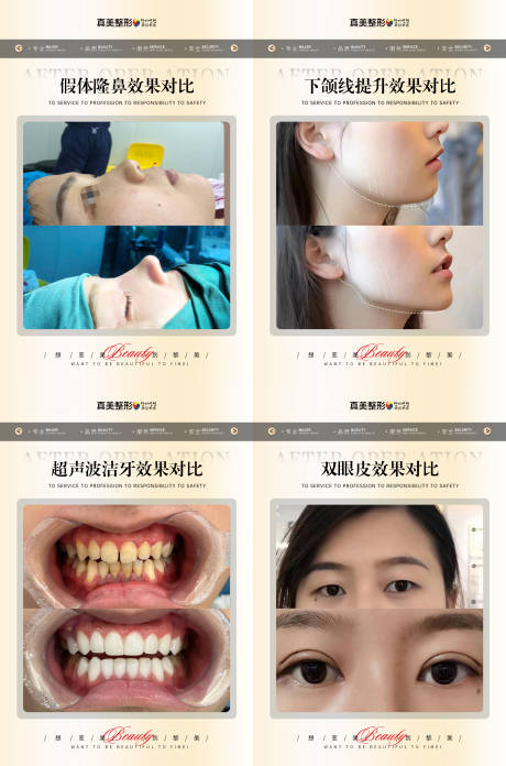 源文件下载【医美轻奢对比案例】编号：92940020495894085