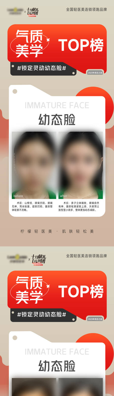 编号：20231118164918163【享设计】源文件下载-医美幼态脸案例系列海报