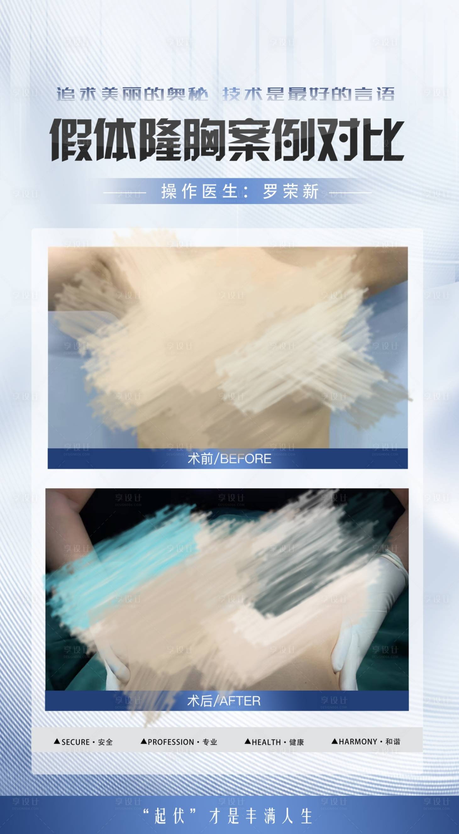 源文件下載【享設計】搜索編號：42900020307173216【醫美隆胸豐胸海報】