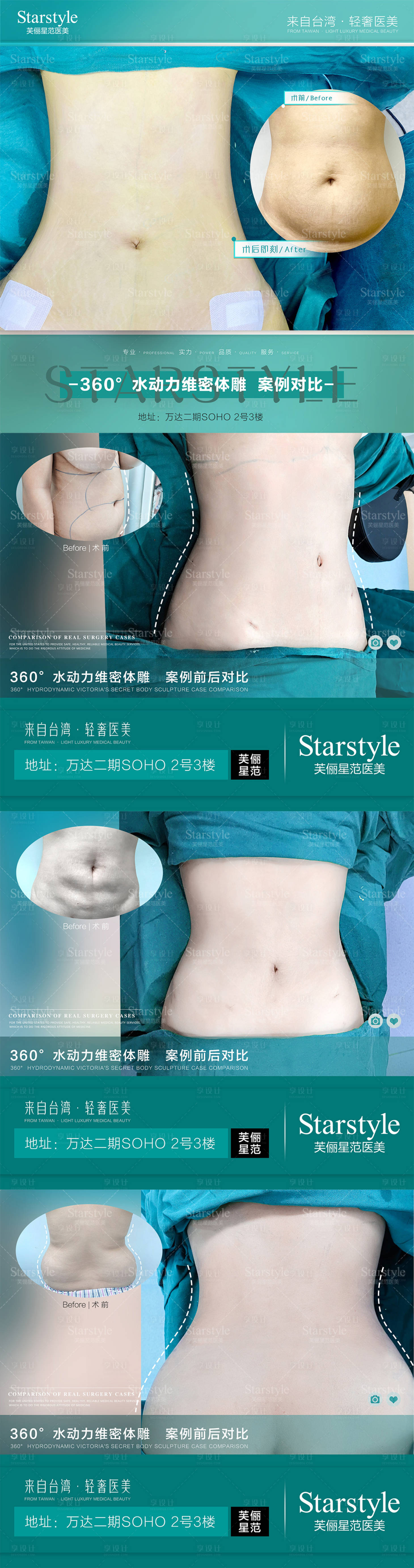 源文件下载【医美吸脂案例对比系列海报】编号：88580020687319131