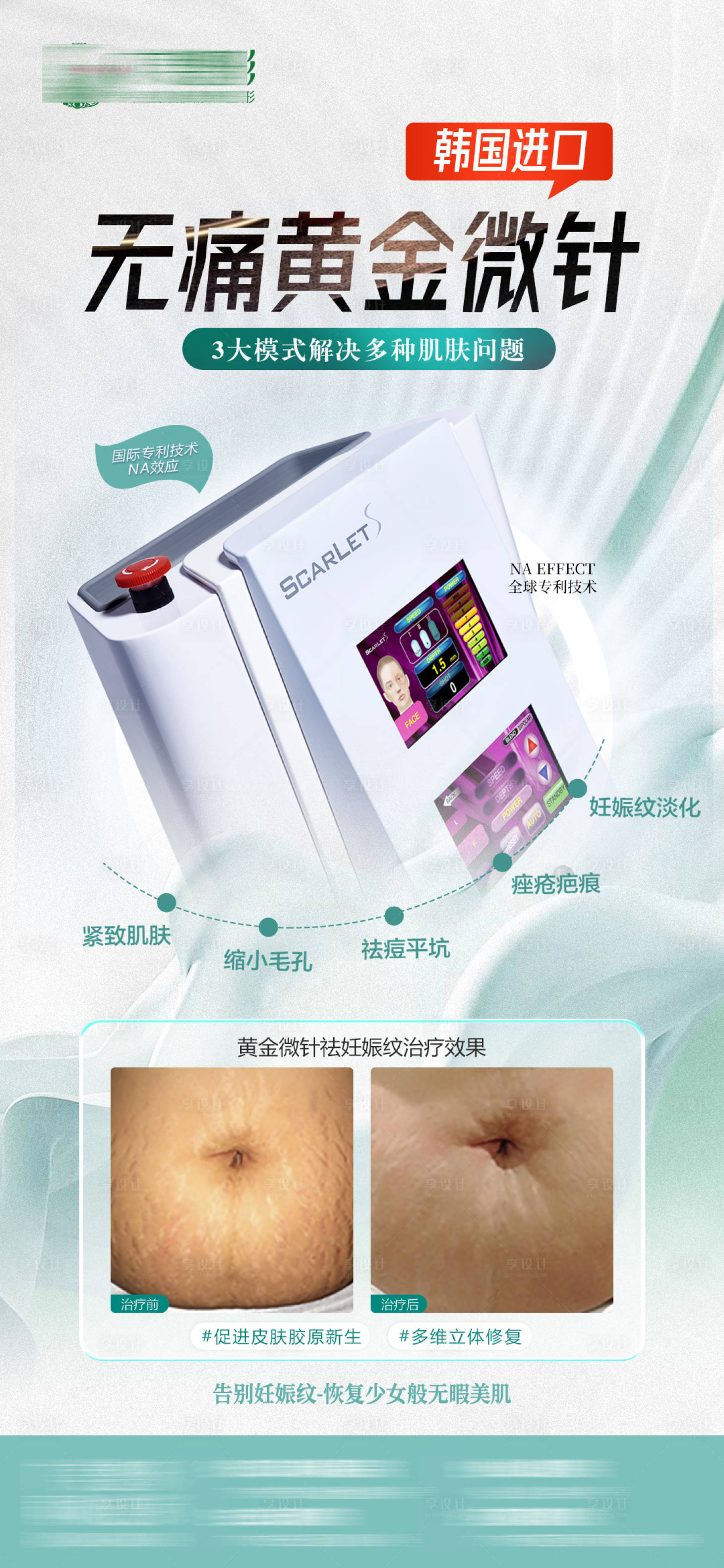 源文件下載【醫美黃金超微針海報】編號：92270020681993996