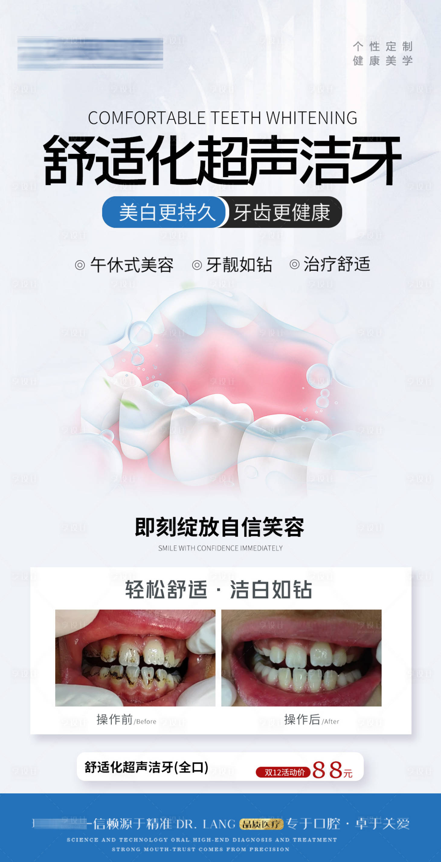 源文件下載【享設(shè)計(jì)】搜索編號(hào)：22620020496843820【醫(yī)美口腔潔牙案例對(duì)比活動(dòng)】