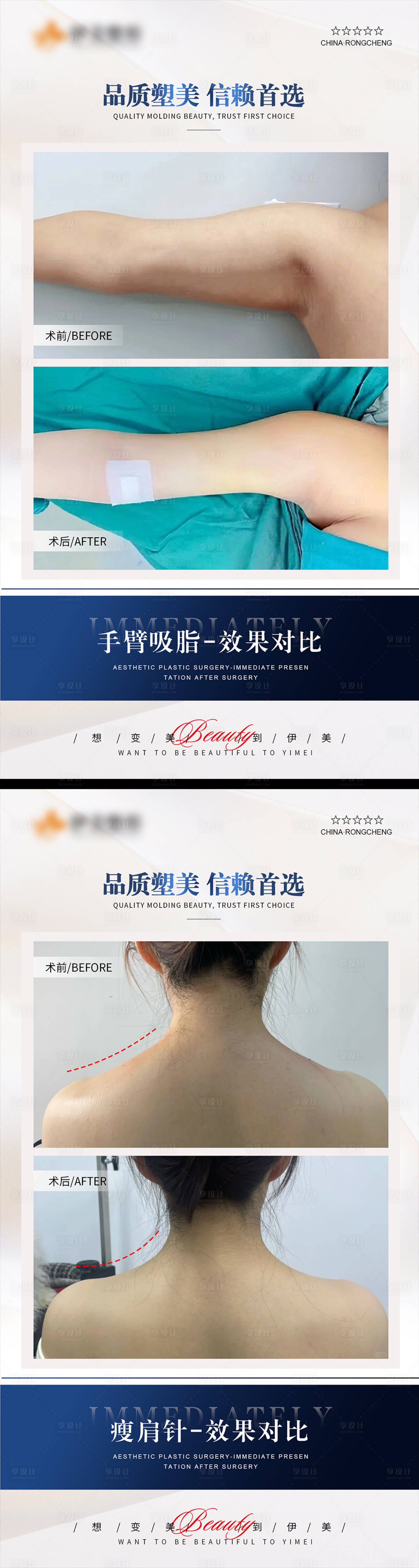 源文件下载【医美案例模板对比海报】编号：58570020214963851