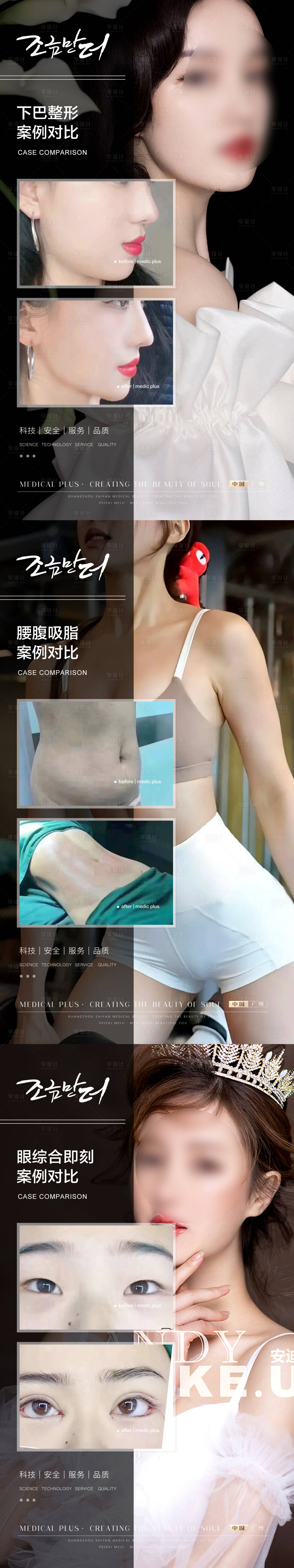源文件下载【医美案例系列海报】编号：10260020238592136