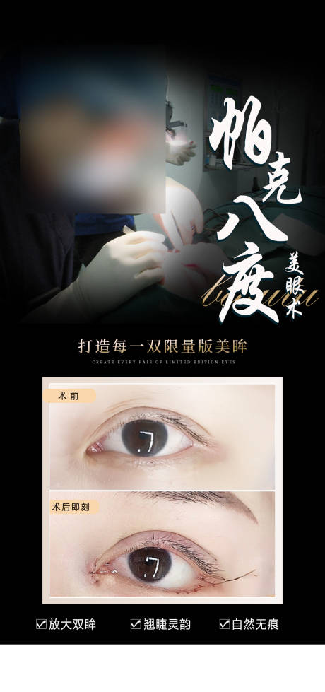 源文件下載【享設計】搜索編號：76760020595466662【醫美美眼術案例海報】