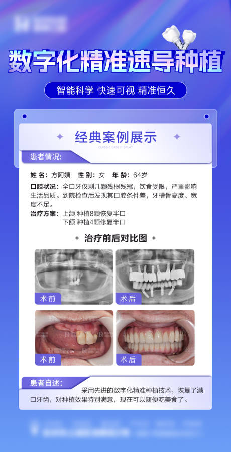 源文件下载【口腔种植牙海报】编号：20231117092337745