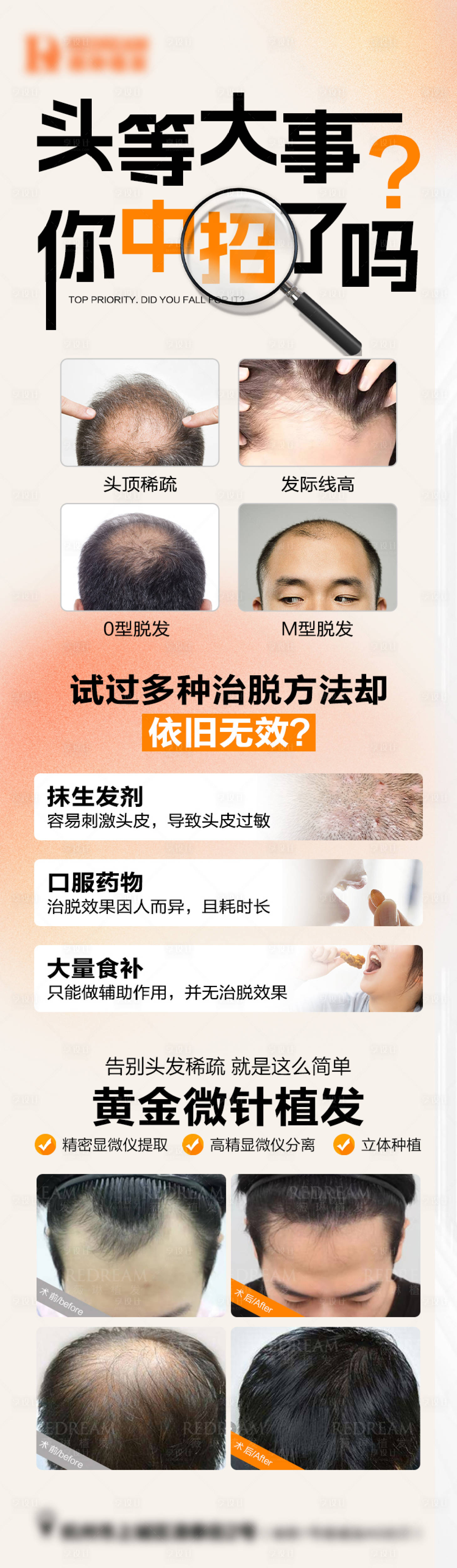 源文件下载【植发】编号：80600020160345003