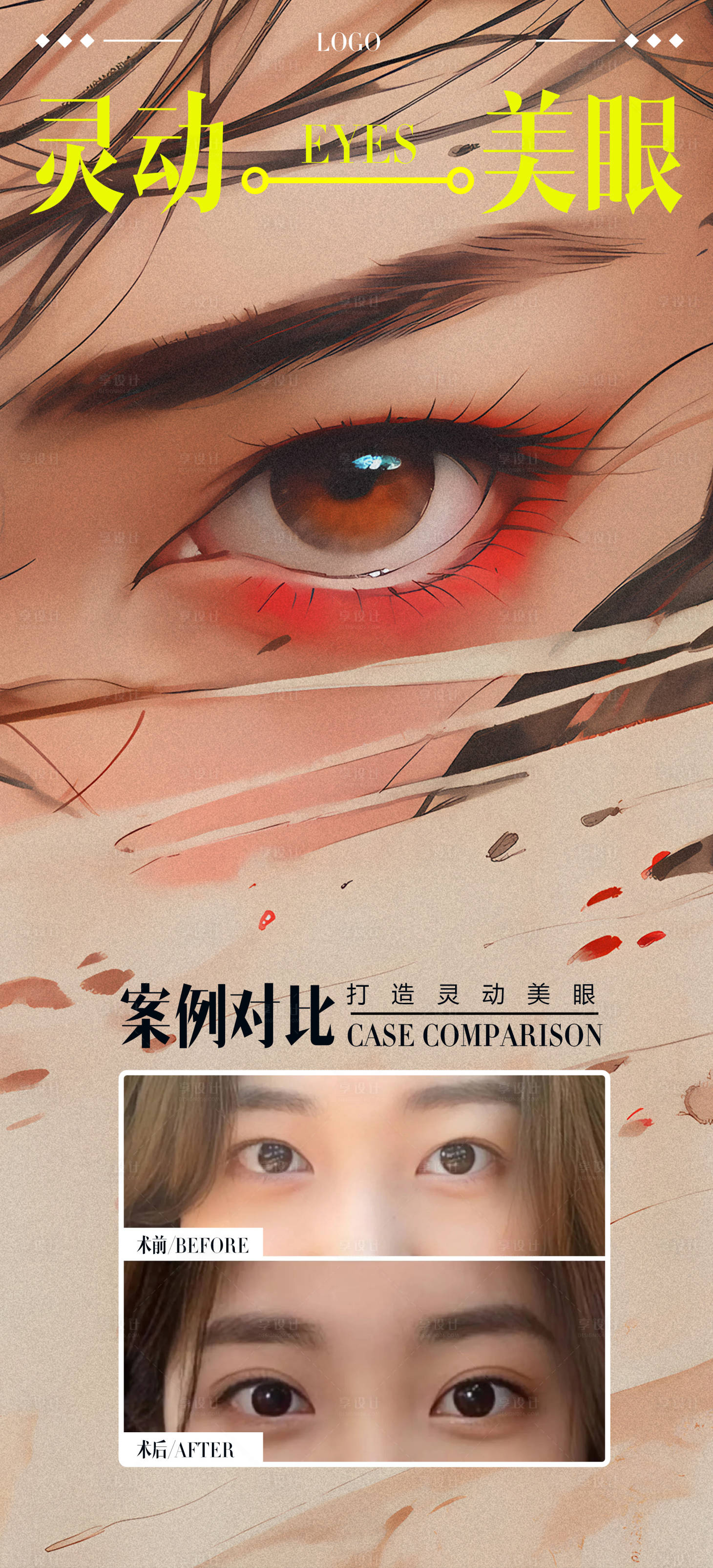 源文件下载【享设计】搜索编号：99400020644553657【双眼皮案例海报】