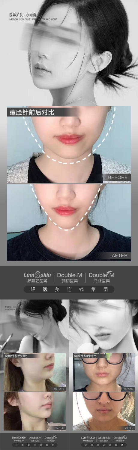 编号：20231130111202710【享设计】源文件下载-医美瘦脸案例对比系列海报