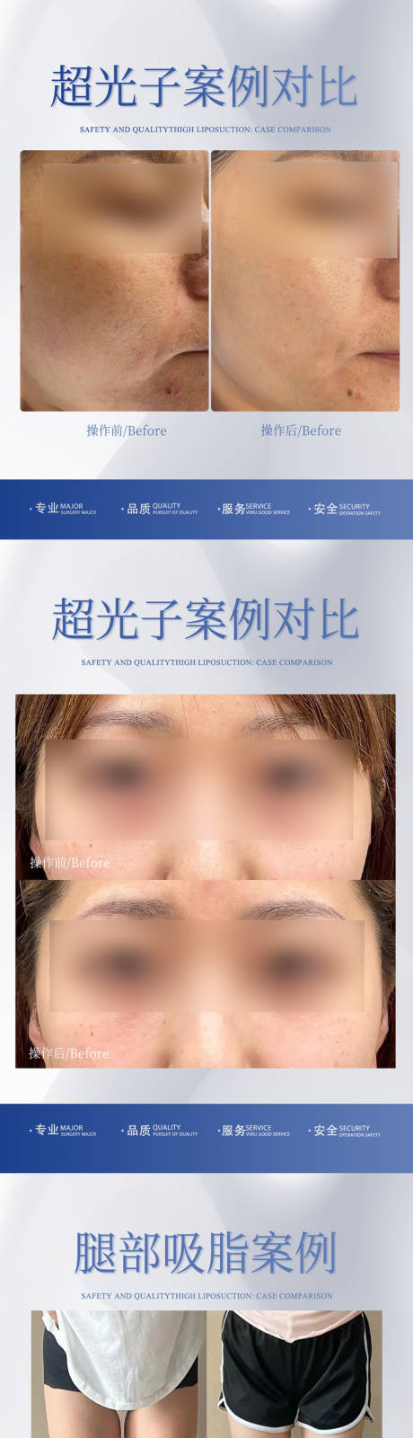 源文件下载【医美整形案例对比】编号：25310020376525432