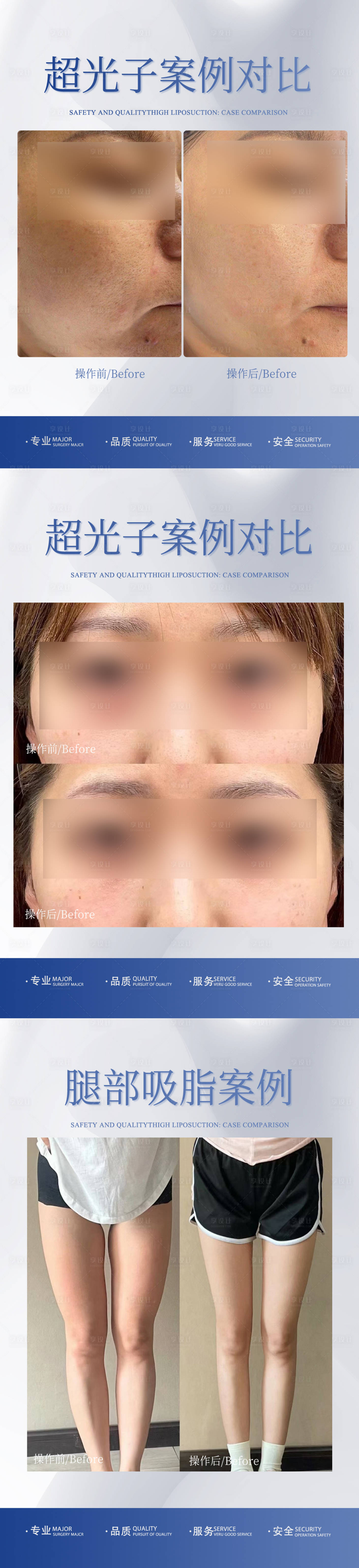 源文件下载【享设计】搜索编号：25310020376525432【医美整形案例对比】