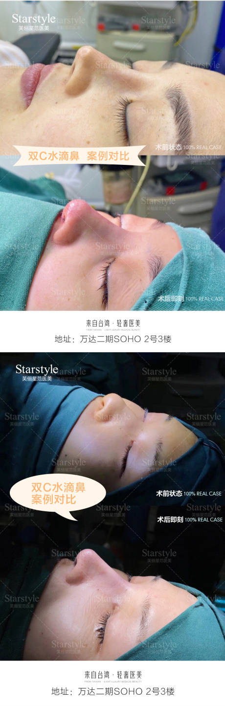 源文件下載【享設計】搜索編號：68510020690343699【醫(yī)美鼻子案例對比】
