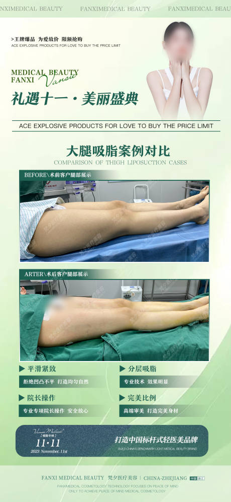 源文件下载【大腿环吸】编号：65450020257723424