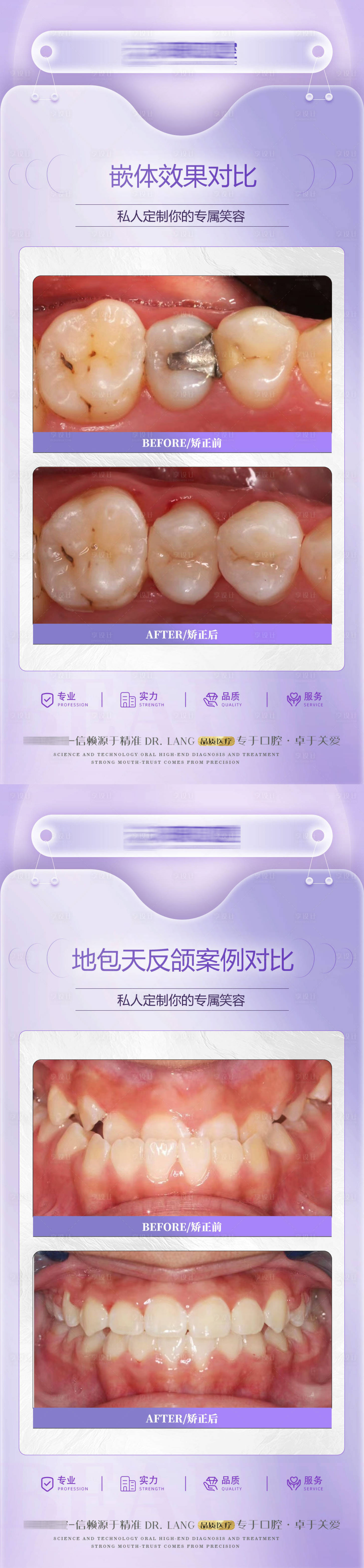 源文件下载【口腔矫正嵌体案例对比】编号：30290020340224869
