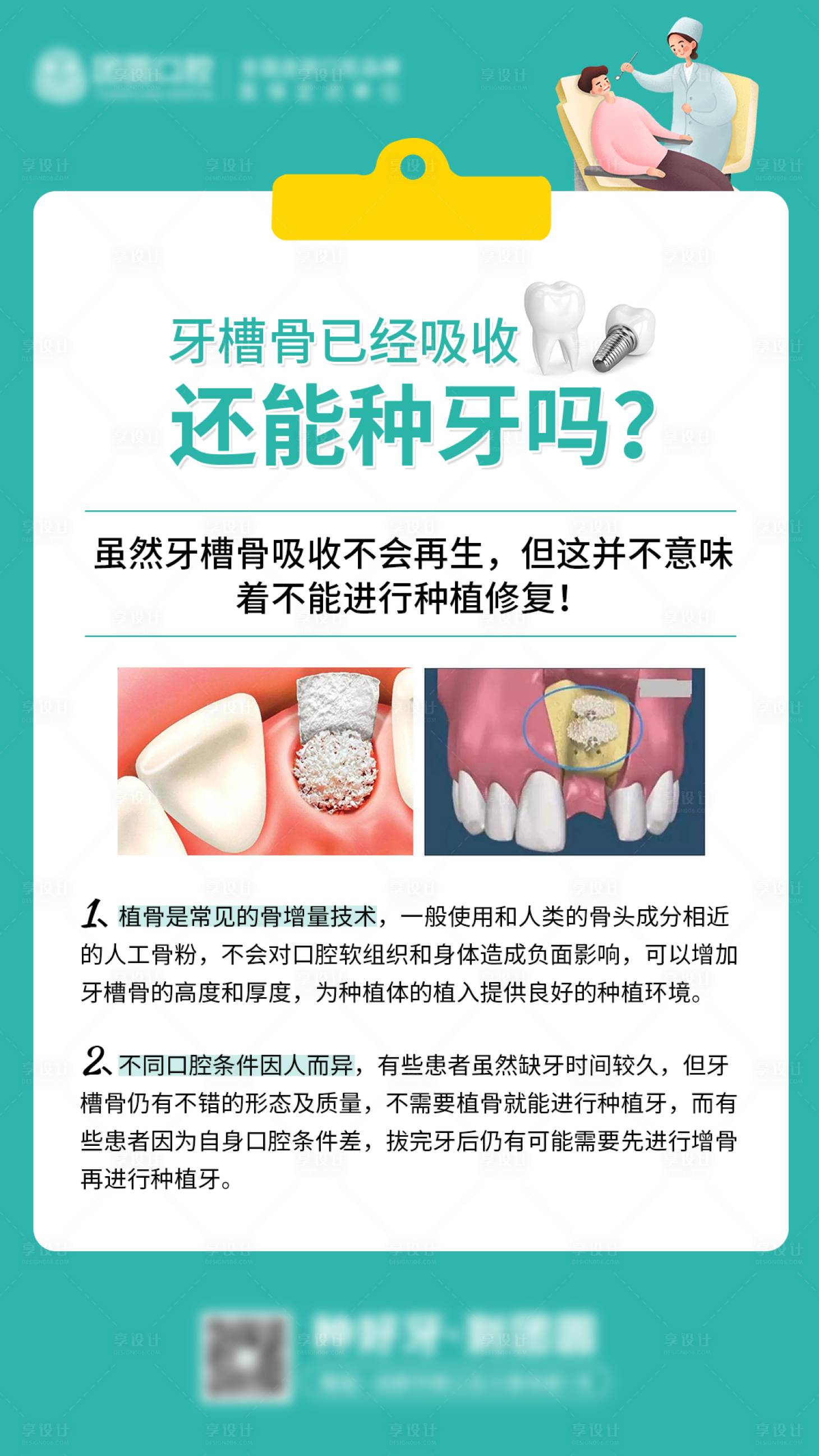 源文件下載【享設(shè)計】搜索編號：93370020692336294【口腔種植牙科普海報】