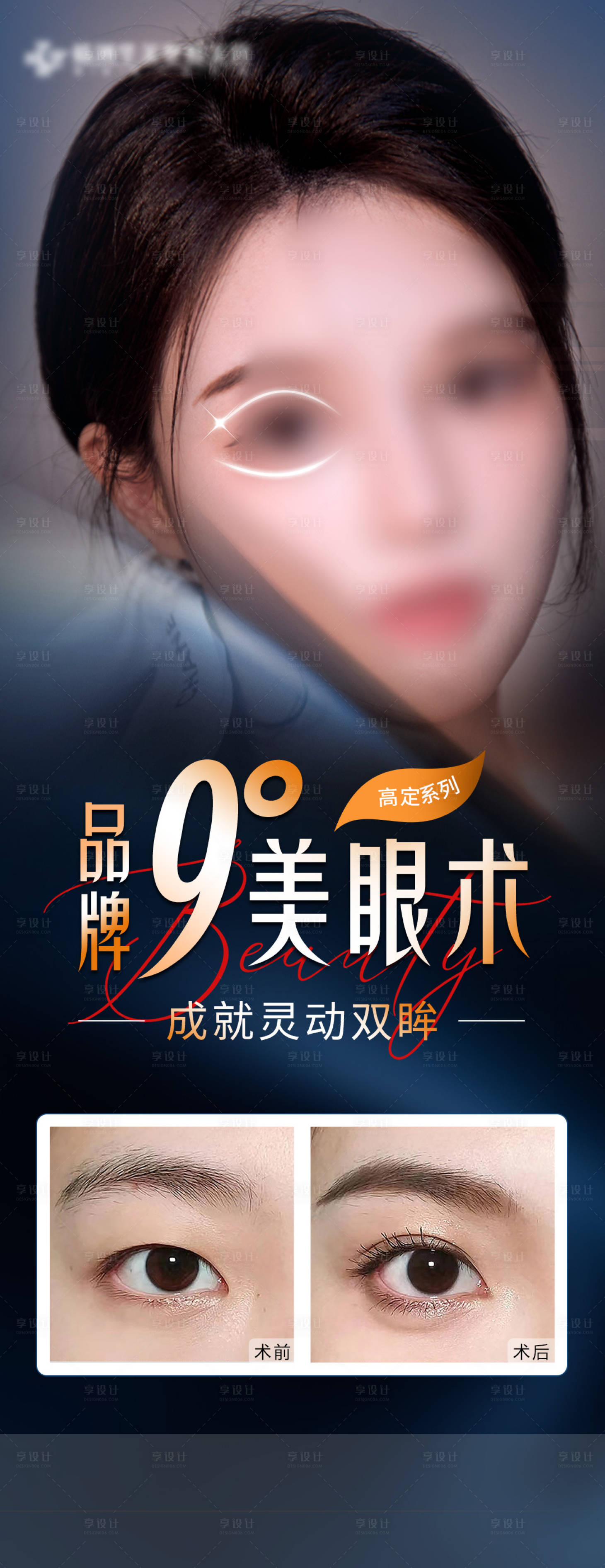 源文件下載【享設(shè)計(jì)】搜索編號：22010020459385581【醫(yī)美雙眼皮案例】