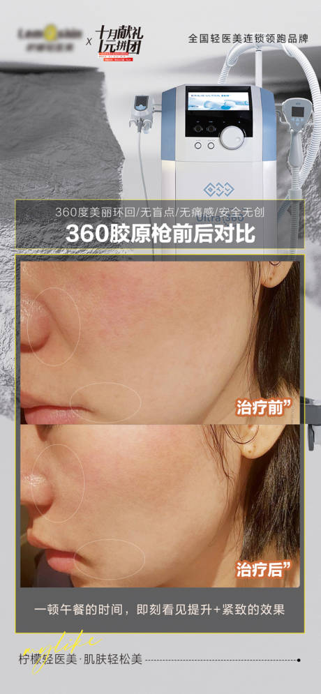 源文件下载【医美抗衰仪器案例对比】编号：31650020690097918