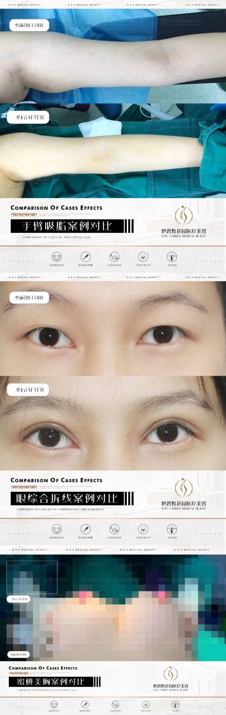 源文件下載【享設(shè)計】搜索編號：55210020499902653【醫(yī)美整形案例效果系列海報】