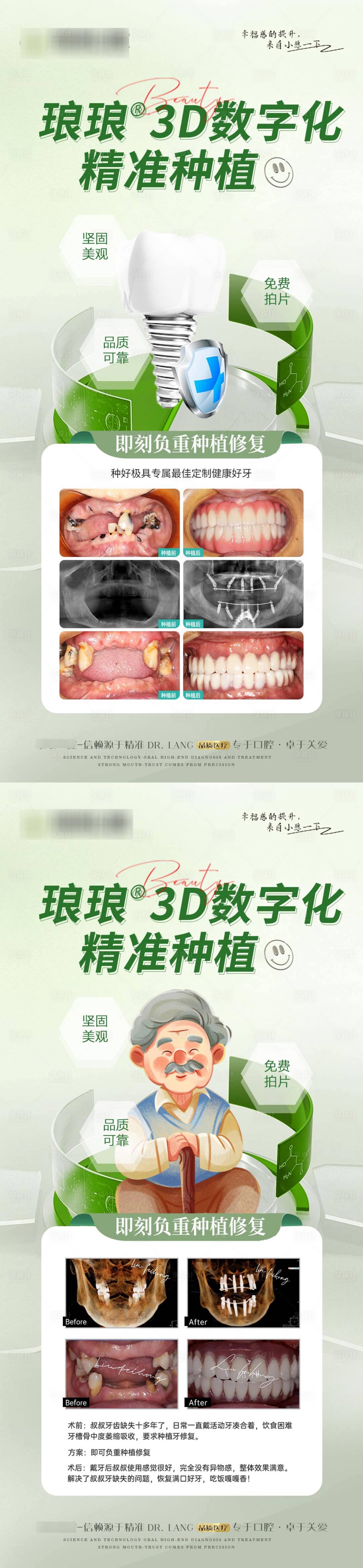 源文件下载【口腔案例种植牙海报】编号：43700020238943411