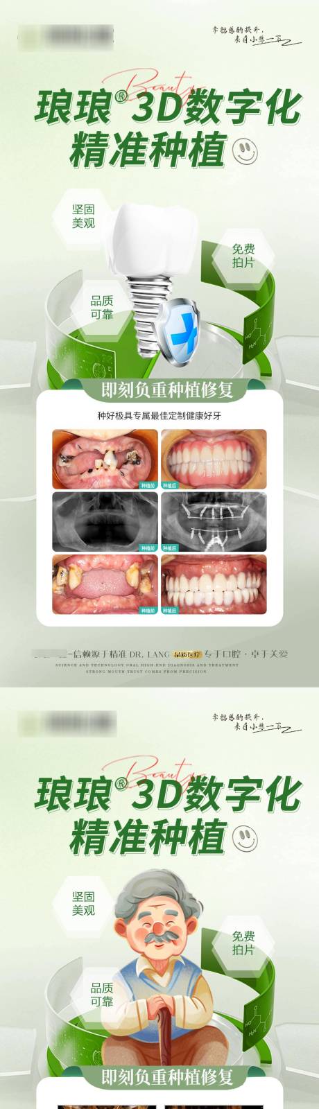 编号：20231106185446190【享设计】源文件下载-口腔案例种植牙海报