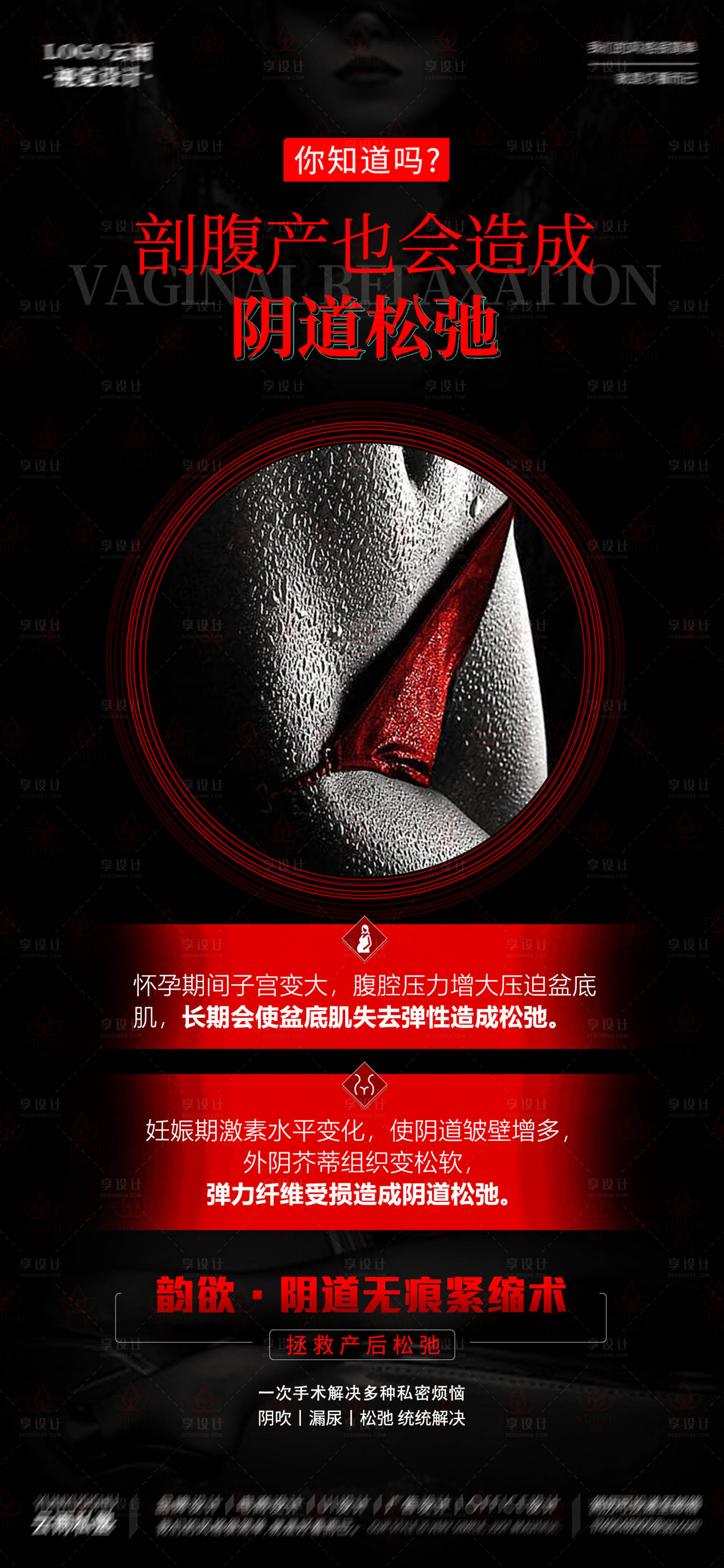 源文件下載【享設(shè)計(jì)】搜索編號(hào)：15800020598798059【刨婦產(chǎn)陰道松弛】