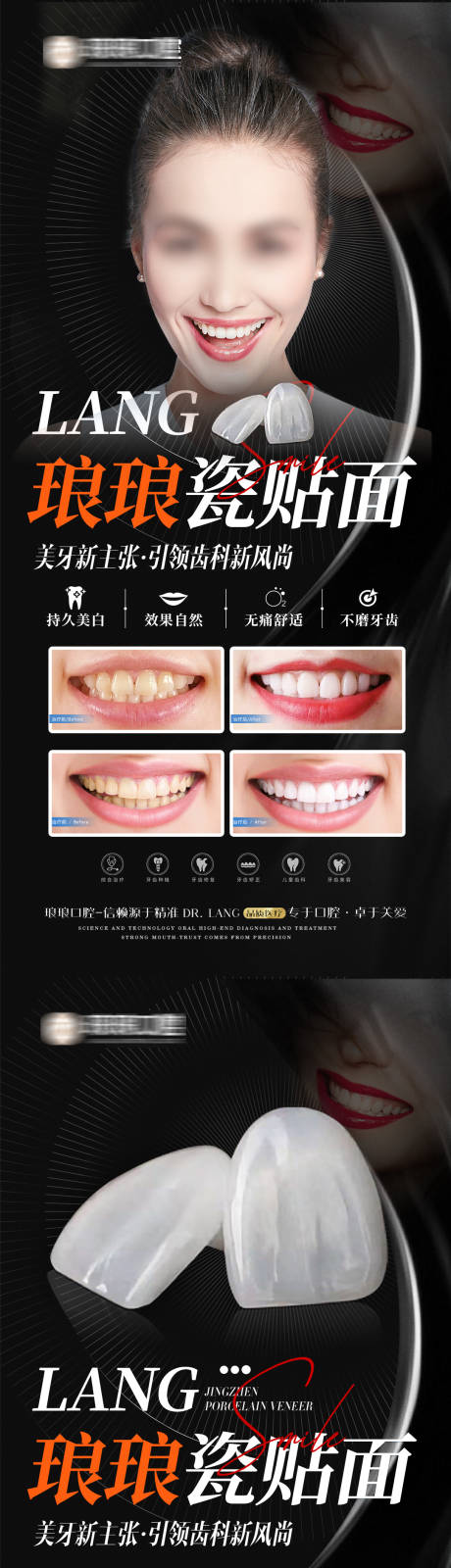 源文件下載【口腔瓷貼面案例海報】編號：45550020469187862