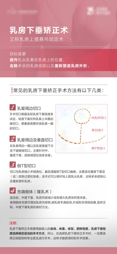 源文件下载【乳房矫正术科普海报】编号：27480020670263156