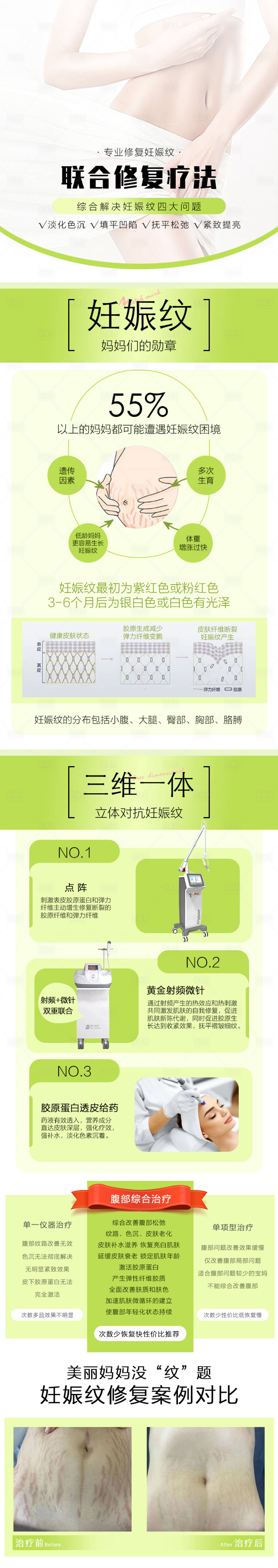 源文件下载【享设计】搜索编号：54540020205932913【修复妊娠纹详情页】
