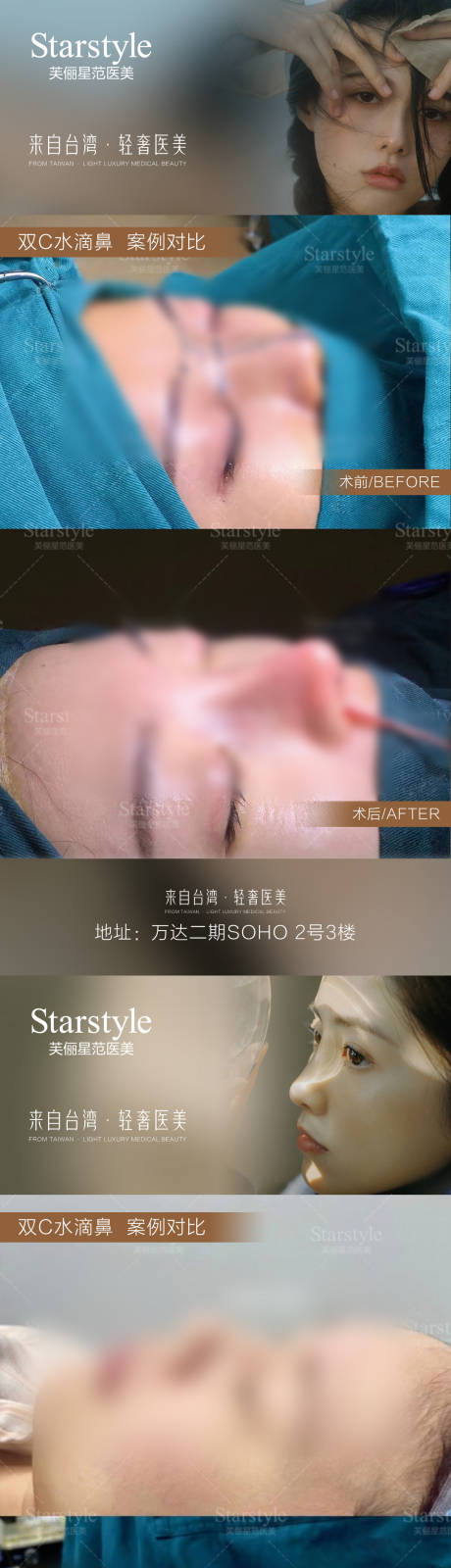 源文件下载【医美鼻子案例对比】编号：20231130111811283