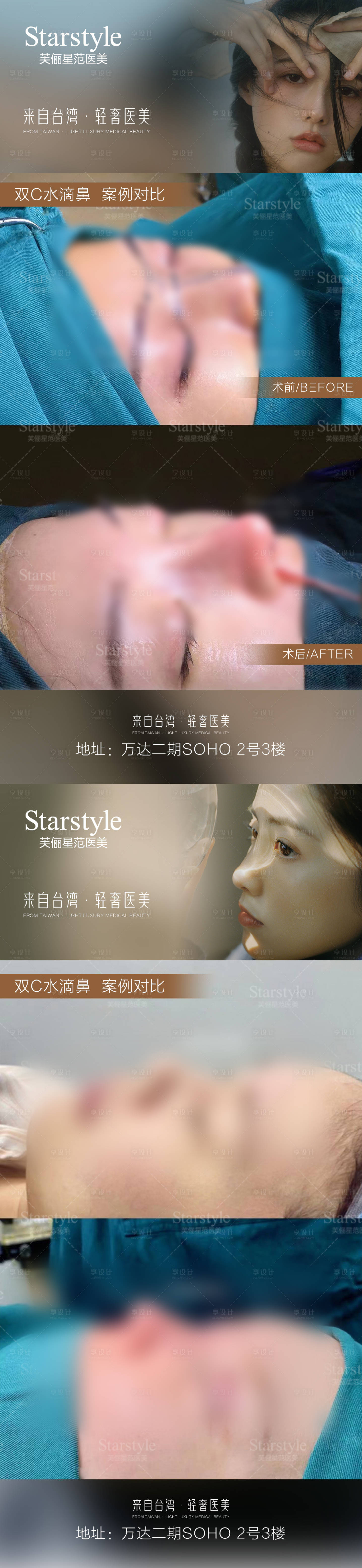 源文件下載【享設計】搜索編號：85310020690443059【醫美鼻子案例對比】