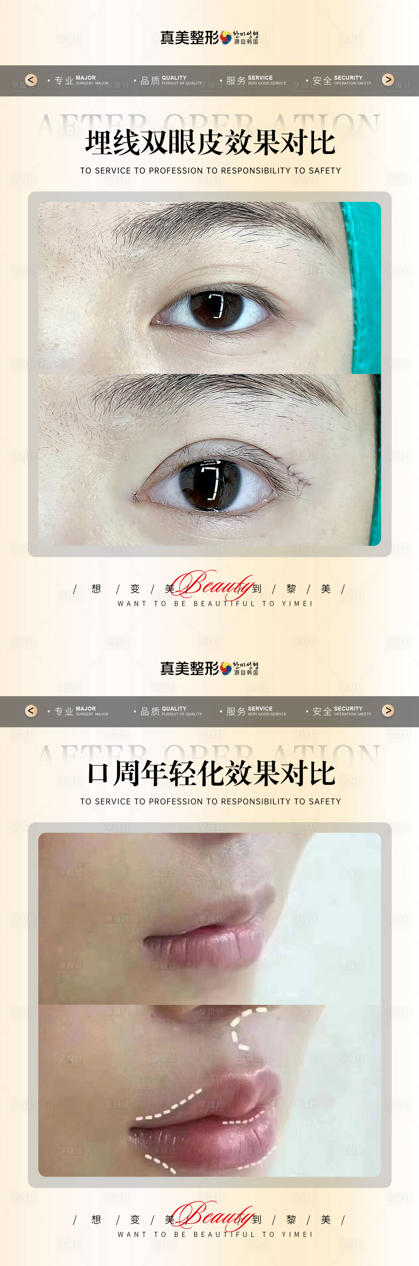 源文件下载【享设计】搜索编号：46540020539789507【医美整形简约案例对比】