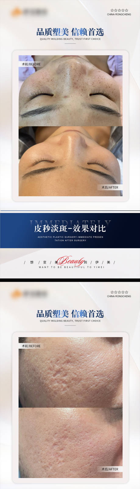 源文件下載【享設計】搜索編號：31370020470168211【醫美案例模板對比海報】